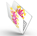 Pink_and_Yellow_Pineapple_-_13_MacBook_Pro_-_V9.jpg