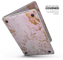 Rose Pink Marble & Digital Gold Frosted Foil V13 - Skin Decal Wrap Kit Compatible with the Apple MacBook Pro, Pro with Touch Bar or Air (11", 12", 13", 15" & 16" - All Versions Available)