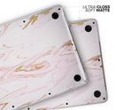 Rose Pink Marble & Digital Gold Frosted Foil V15 - Skin Decal Wrap Kit Compatible with the Apple MacBook Pro, Pro with Touch Bar or Air (11", 12", 13", 15" & 16" - All Versions Available)