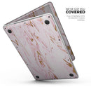 Rose Pink Marble & Digital Gold Frosted Foil V15 - Skin Decal Wrap Kit Compatible with the Apple MacBook Pro, Pro with Touch Bar or Air (11", 12", 13", 15" & 16" - All Versions Available)