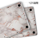 Rose Pink Marble & Digital Gold Frosted Foil V1 - Skin Decal Wrap Kit Compatible with the Apple MacBook Pro, Pro with Touch Bar or Air (11", 12", 13", 15" & 16" - All Versions Available)
