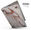 Rose Pink Marble & Digital Gold Frosted Foil V2 - Skin Decal Wrap Kit Compatible with the Apple MacBook Pro, Pro with Touch Bar or Air (11", 12", 13", 15" & 16" - All Versions Available)