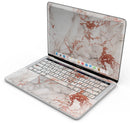 Rose Pink Marble & Digital Gold Frosted Foil V5 - Skin Decal Wrap Kit Compatible with the Apple MacBook Pro, Pro with Touch Bar or Air (11", 12", 13", 15" & 16" - All Versions Available)