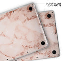 Rose Pink Marble & Digital Gold Frosted Foil V6 - Skin Decal Wrap Kit Compatible with the Apple MacBook Pro, Pro with Touch Bar or Air (11", 12", 13", 15" & 16" - All Versions Available)