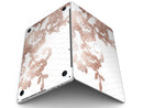 Rose_Gold_Lace_Pattern_10_-_13_MacBook_Pro_-_V3.jpg