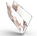 Rose_Gold_Lace_Pattern_10_-_13_MacBook_Pro_-_V9.jpg