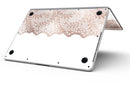 Rose_Gold_Lace_Pattern_5_-_13_MacBook_Pro_-_V8.jpg