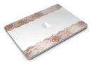 Rose_Gold_Lace_Pattern_8_-_13_MacBook_Air_-_V2.jpg