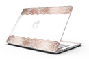 Rose_Gold_Lace_Pattern_8_-_13_MacBook_Pro_-_V1.jpg