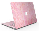 Shabby Chic Pink Watercolor Stripes - MacBook Air Skin Kit