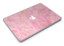 Shabby Chic Pink Watercolor Stripes - MacBook Air Skin Kit