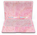 Shabby Chic Pink Watercolor Stripes - MacBook Air Skin Kit