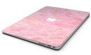 Shabby Chic Pink Watercolor Stripes - MacBook Air Skin Kit