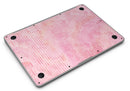 Shabby Chic Pink Watercolor Stripes - MacBook Air Skin Kit