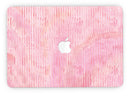 Shabby Chic Pink Watercolor Stripes - MacBook Pro with Retina Display Full-Coverage Skin Kit