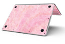 Shabby Chic Pink Watercolor Stripes - MacBook Pro with Retina Display Full-Coverage Skin Kit