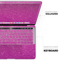 Sparkling Pink Ultra Metallic Glitter - Skin Decal Wrap Kit Compatible with the Apple MacBook Pro, Pro with Touch Bar or Air (11", 12", 13", 15" & 16" - All Versions Available)