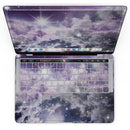 MacBook Pro with Touch Bar Skin Kit - Sparkly_Space-MacBook_13_Touch_V4.jpg?