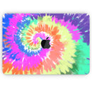 Spiral Tie Dye V1 // Skin Decal Wrap Kit Compatible with the Apple MacBook Pro, Pro with Touch Bar or Air (11, 12, 13, 15 & 16" - All Versions Available)