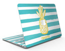 Striped_Mint_and_Gold_Pineapple_-_13_MacBook_Air_-_V1.jpg