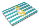 Striped_Mint_and_Gold_Pineapple_-_13_MacBook_Air_-_V2.jpg