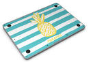 Striped_Mint_and_Gold_Pineapple_-_13_MacBook_Air_-_V9.jpg