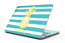 Striped_Mint_and_Gold_Pineapple_-_13_MacBook_Pro_-_V1.jpg