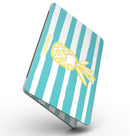 Striped_Mint_and_Gold_Pineapple_-_13_MacBook_Pro_-_V2.jpg