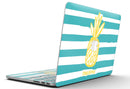 Striped_Mint_and_Gold_Pineapple_-_13_MacBook_Pro_-_V5.jpg