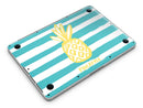 Striped_Mint_and_Gold_Pineapple_-_13_MacBook_Pro_-_V6.jpg