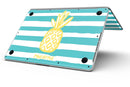 Striped_Mint_and_Gold_Pineapple_-_13_MacBook_Pro_-_V8.jpg