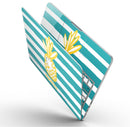 Striped_Mint_and_Gold_Pineapple_-_13_MacBook_Pro_-_V9.jpg