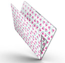 The_All_Over_Watermelon_Slice_Pattern_-_13_MacBook_Pro_-_V9.jpg