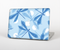 The Blue DragonFly Skin Set for the Apple MacBook Air 11"
