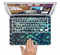The Blue & Teal Lace Texture Skin Set for the Apple MacBook Air 11"