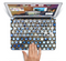 The Blue Tiled Abstract Pattern Skin Set for the Apple MacBook Air 11"
