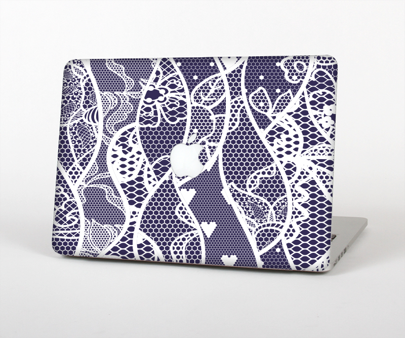 The Dark Blue & White Lace Design Skin Set for the Apple MacBook Pro 15" with Retina Display