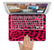 The Fuzzy Real Pink Leopard Print Skin Set for the Apple MacBook Air 11"