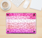 The Hot Pink Striped Cheetah Print Skin Kit for the 12" Apple MacBook (A1534)