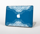 The Intricate Blue & White Snowflake Name Script Skin for the Apple MacBook Air 13"