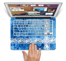 The Vibrant Blue & White Floral Lace Skin Set for the Apple MacBook Air 13"