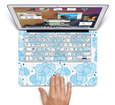 The White and Blue Raining Yarn Clouds Skin Set for the Apple MacBook Pro 15"