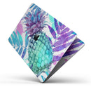 Tropical Summer Pineapple v1 - Skin Decal Wrap Kit Compatible with the Apple MacBook Pro, Pro with Touch Bar or Air (11", 12", 13", 15" & 16" - All Versions Available)