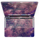 MacBook Pro with Touch Bar Skin Kit - Vibrant_Sparkly_Pink_Nebula-MacBook_13_Touch_V4.jpg?