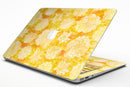 Yellow Floral Succulents - MacBook Air Skin Kit