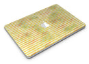 Yellow Watercolor Stripes - MacBook Air Skin Kit