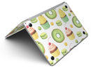 Yummy_Galore_Bakery_Green_Treats_V1_-_13_MacBook_Air_-_V3.jpg